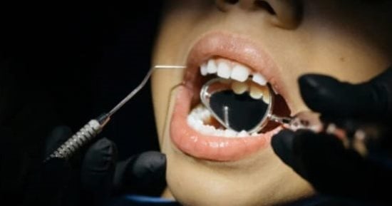 عدوى زراعة الأسنان.. 9 علامات تكشف الإصابة وأسبابها وطرق الوقاية والعلاج