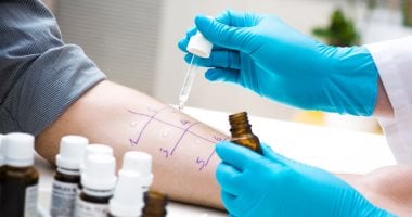 بينها تغير الصوت.. 4 علامات غير متوقعة للإصابة بحساسية الطعام