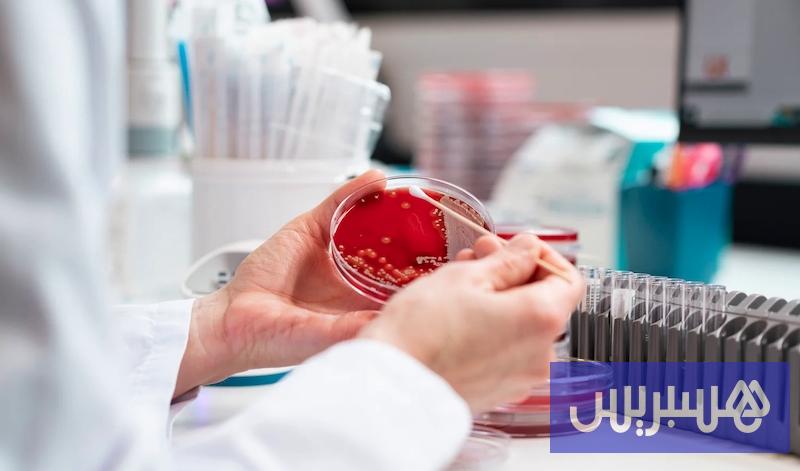 دراسة مغربية: "فحص مخبري سريع" يكشف مسببات التهاب السحايا