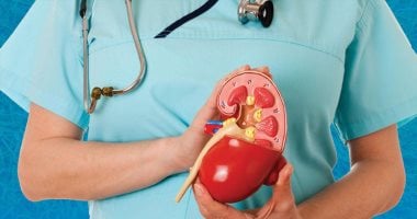 طرق طبيعية تساعد فى التخلص من حصى الكلى