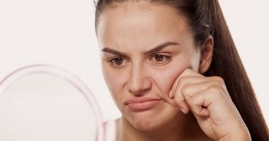 علامات ارتفاع الكوليسترول تظهر على الوجه.. انتبه لهذه العلامات حول العينين