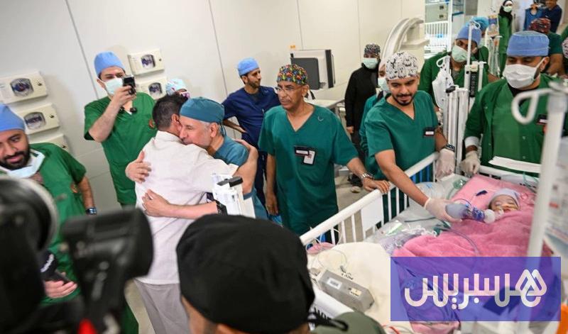 أطباء سعوديون يفصلون توأما مغربيا
