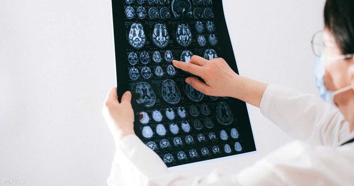ورم شرس ينتشر إلى الدماغ.. تقنية علاجية تفتح باب الأمل